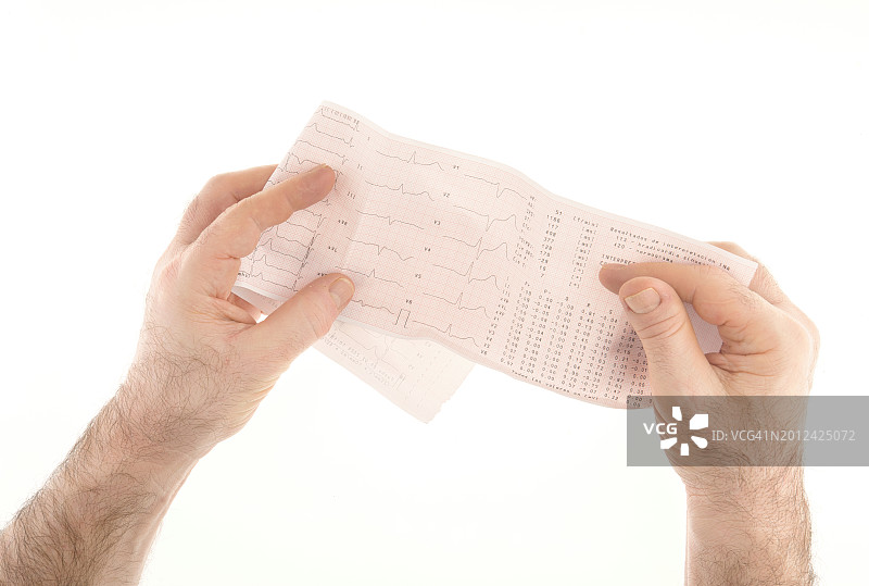 患有窦性心动过缓的病人图片素材