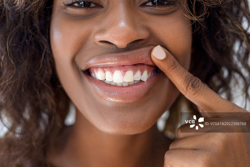 展示健康牙龈的女人图片素材