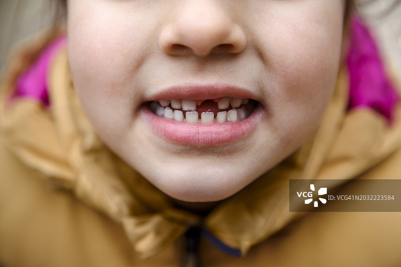 牙齿缝隙图片素材