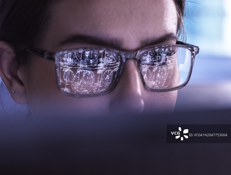 神经外科医生在电脑上检查大脑X光片图片素材