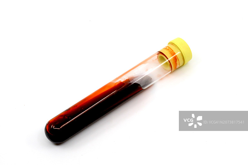 血液样本检测图片素材