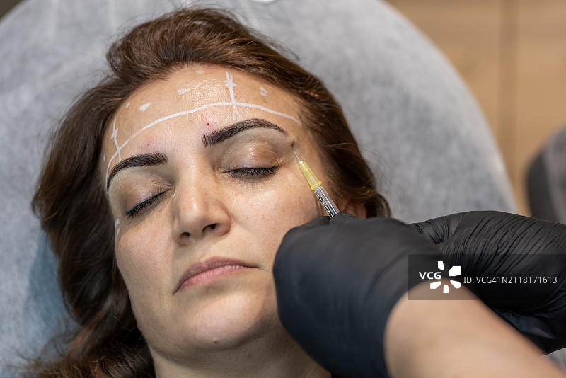 面部美容手术图片素材