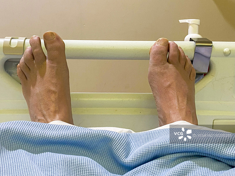 病人的脚在病床上。图片素材