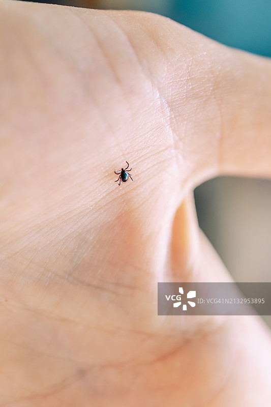 手掌上的蜱虫，硬蜱总科图片素材