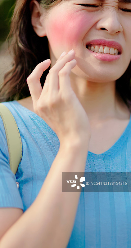 亚洲年轻女孩晒伤脸图片素材