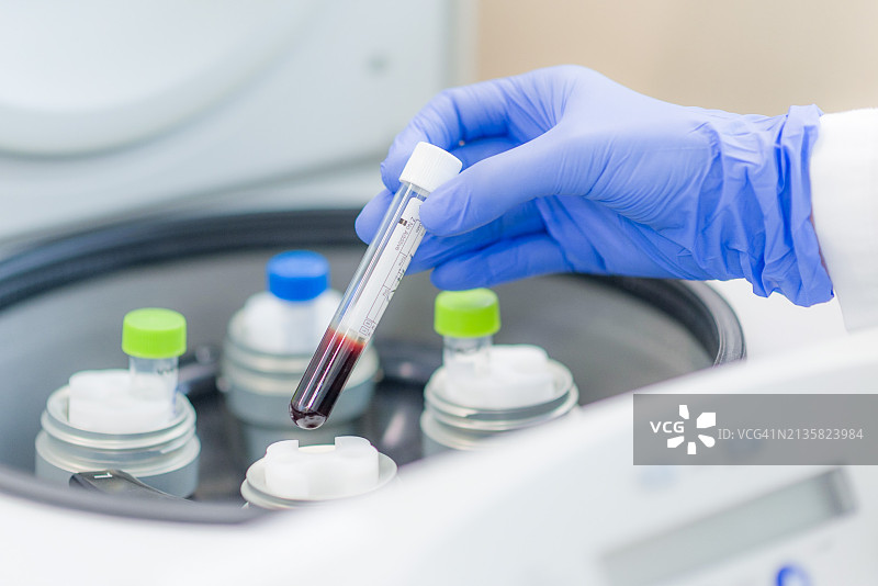 医生在离心医疗设备中手持血液样本图片素材