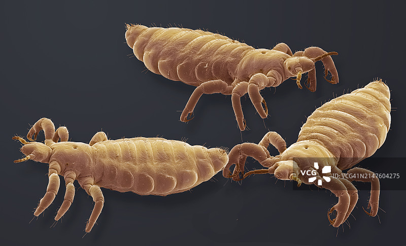 头虱扫描电镜图图片素材