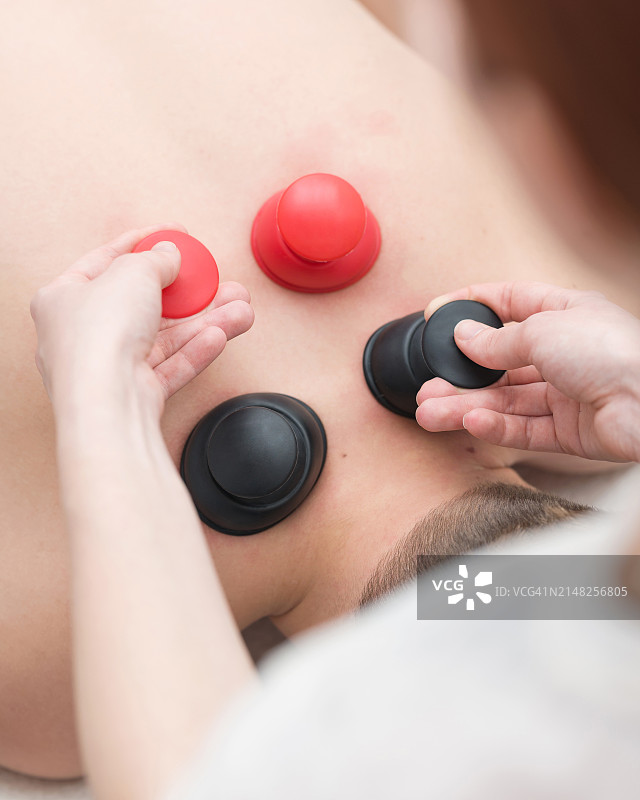 医生为患者进行真空背部按摩。硅胶罐。女理疗师为男子进行真空拔罐按摩。淋巴引流，血液流动。俯视图。特写图片素材