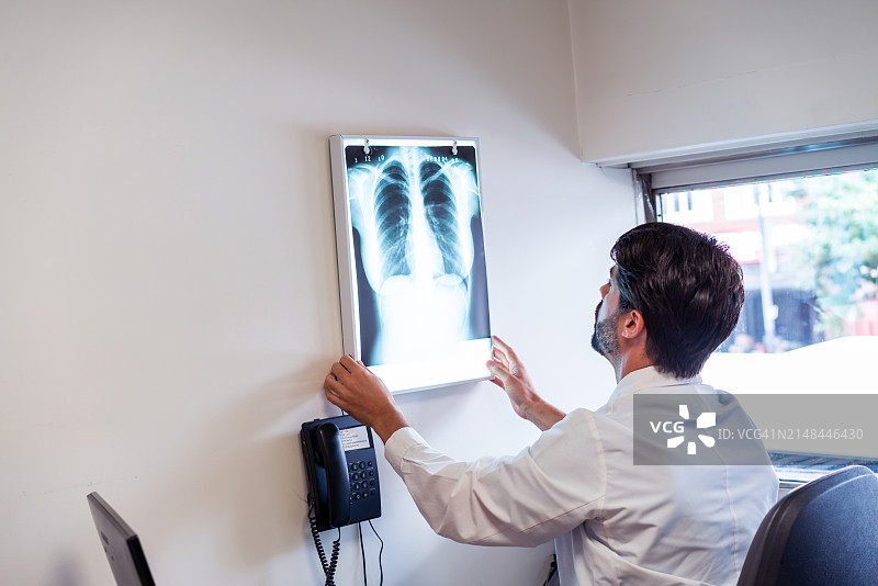 放射科医生在医疗办公室分析胸部X光片图片素材