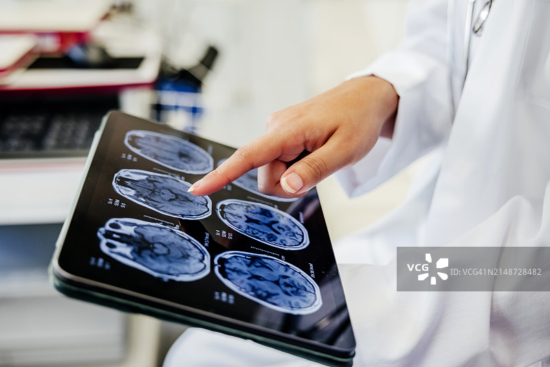 医生在平板电脑上展示脑部扫描图像的特写图片素材