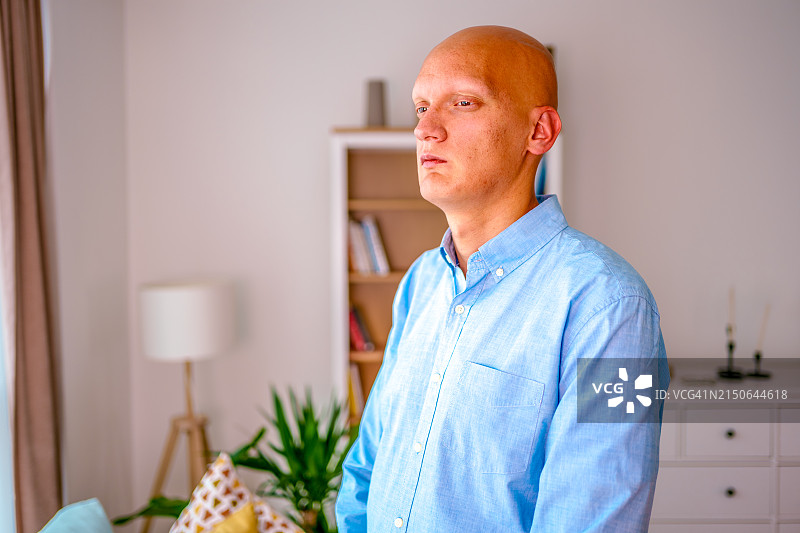 因化疗药物导致秃头的患癌年轻男人图片素材