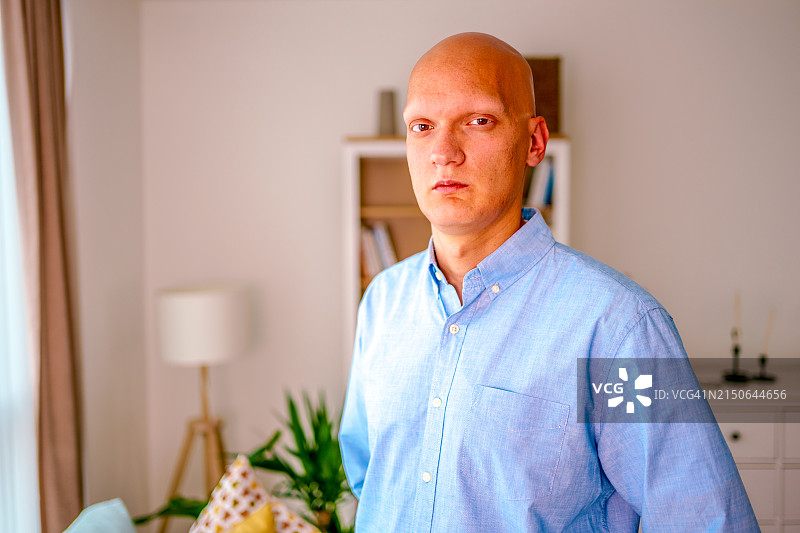患癌症的青年男人站在室内家中，他正在看镜头。由于化疗药物，他的头是秃的图片素材