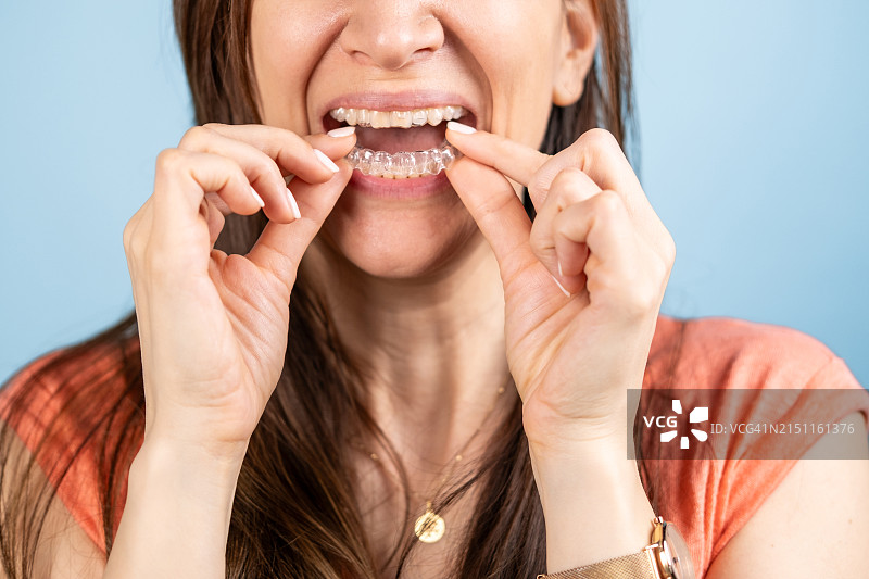 女人戴牙套图片素材
