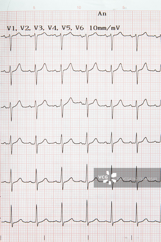 心电图与人心图片素材