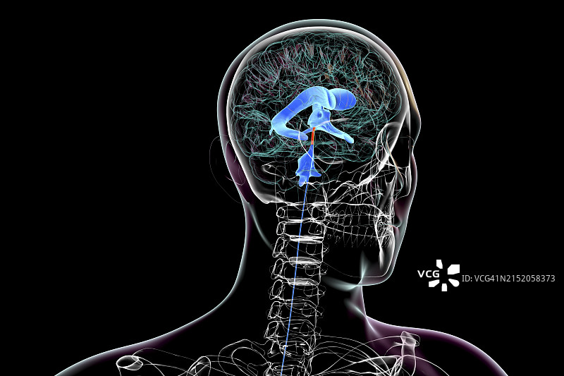 脑导水管图示图片素材