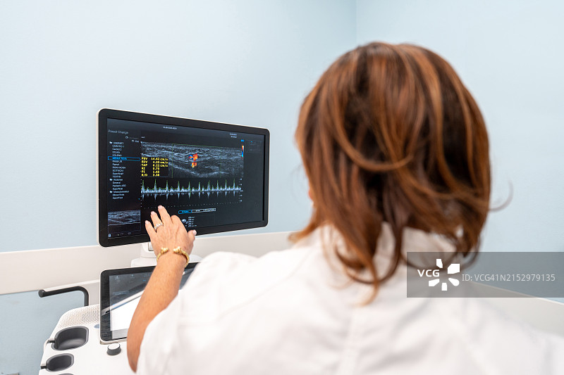 行动中的中年白人女性医学超声医师图片素材