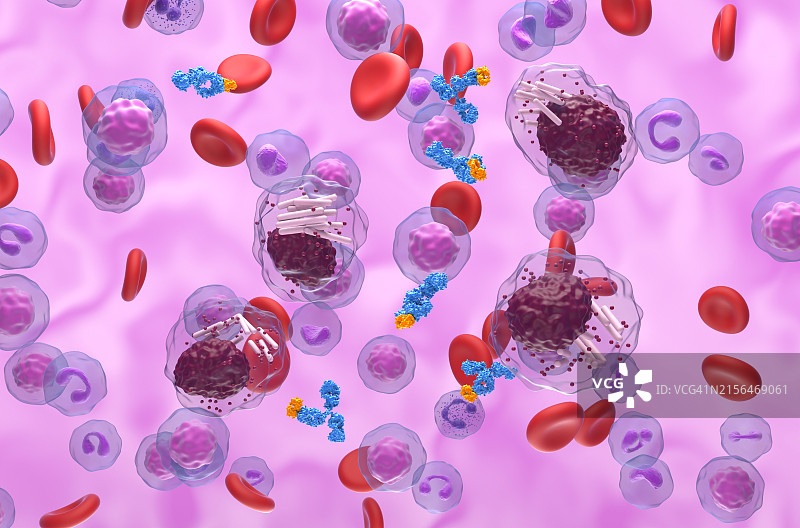 攻击癌性白细胞前体的单克隆抗体，图示图片素材