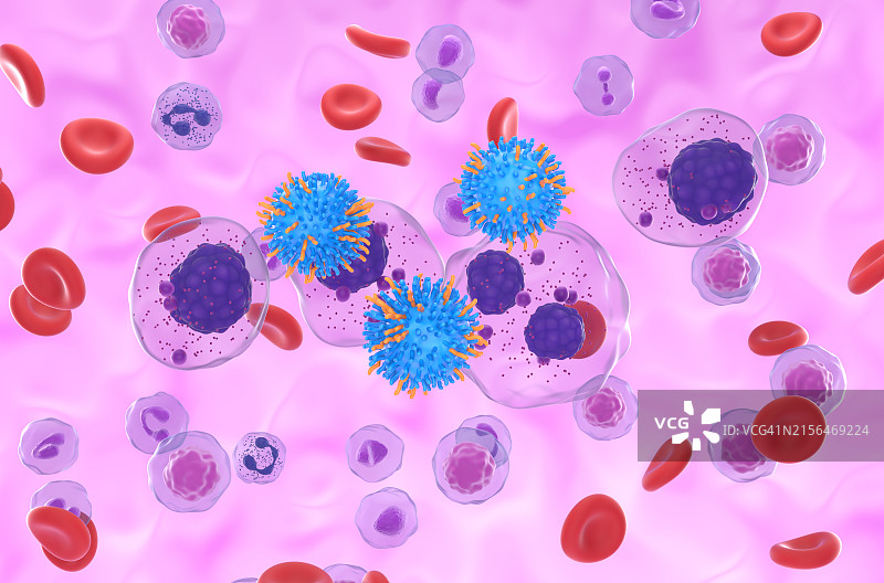 多发性骨髓瘤CAR-T细胞疗法，图示图片素材