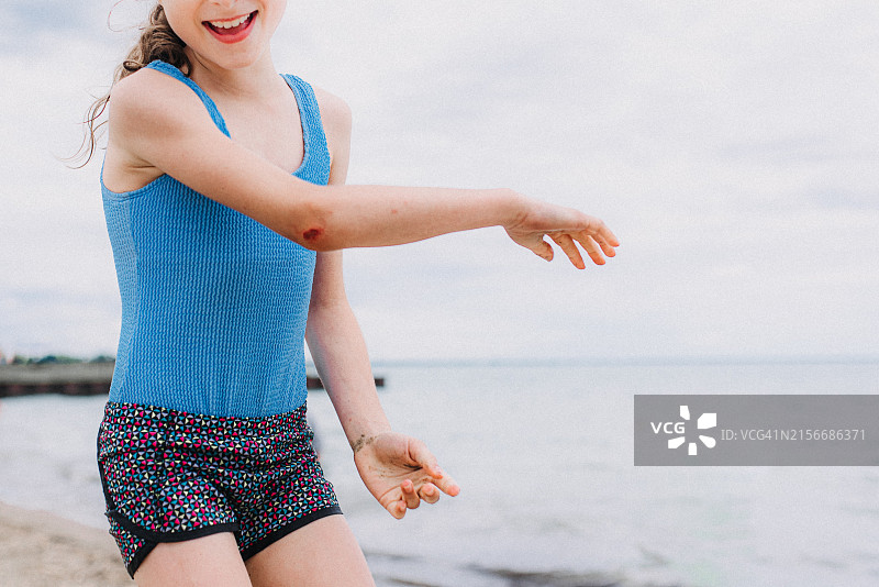 孩子展示受伤的手肘图片素材