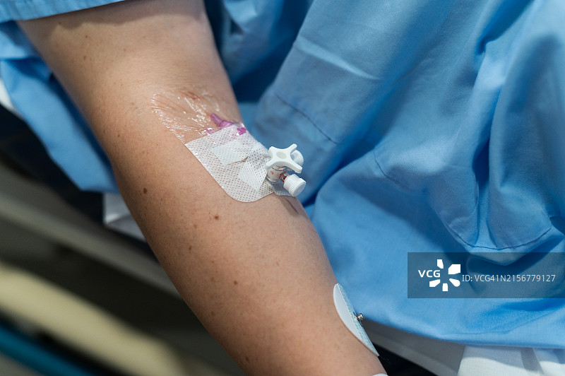 患者在病床上接受静脉输液治疗图片素材