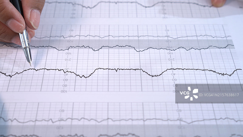心电图数据分析图片素材
