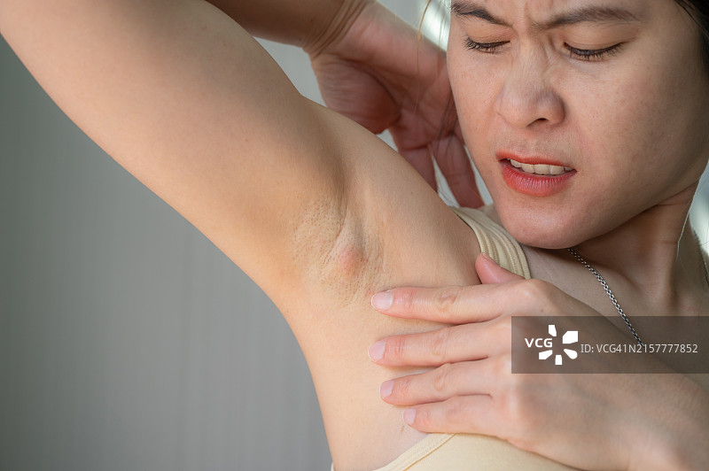 亚洲女性腋窝淋巴结肿大图片素材