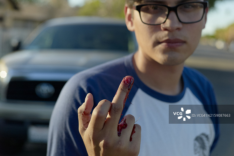 男人面露担忧，展示受伤流血的手指，背景模糊有车辆图片素材