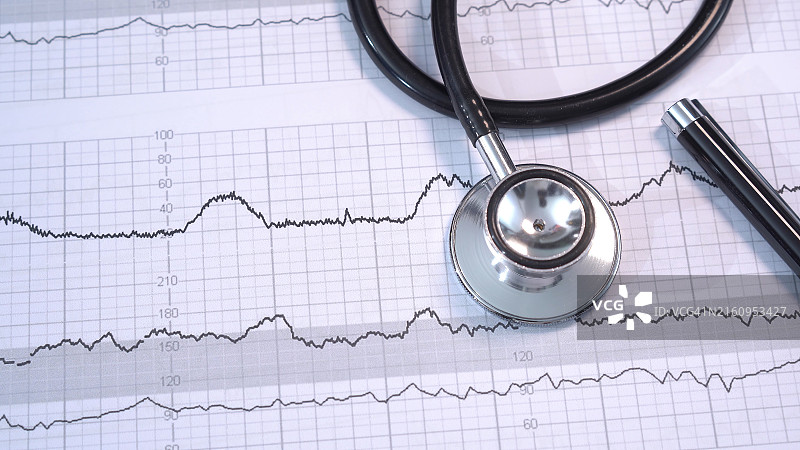 心跳图纸上的听诊器图片素材