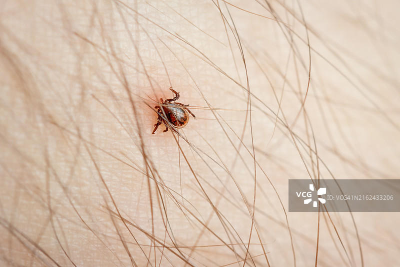 附着在人体皮肤上的蜱虫微距特写图片素材