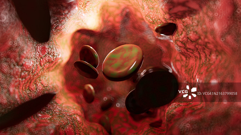 血管中受感染的血细胞图片素材