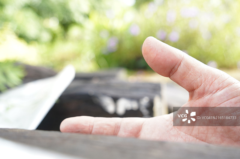 拇指上的瘀伤图片素材