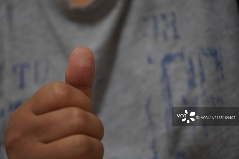 流血的拇指刀伤图片素材