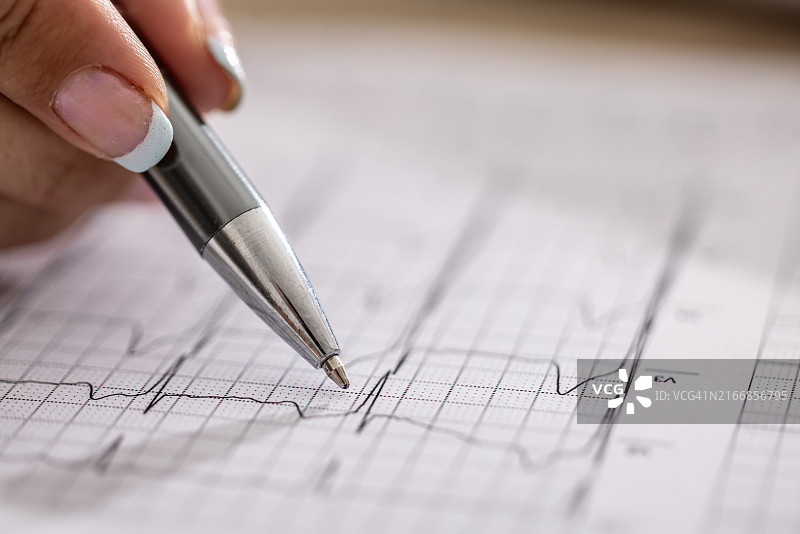 心电图显示医生检查的健康患者的规律心律特写图片素材