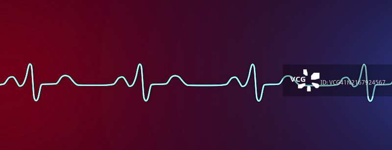 束支传导阻滞心电图插图图片素材