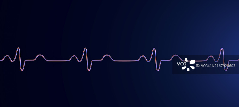 束支传导阻滞心电图插图图片素材