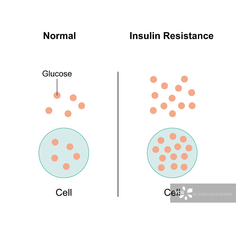 胰岛素抵抗示意图图片素材