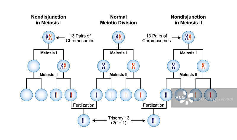 13-三体综合征插图图片素材
