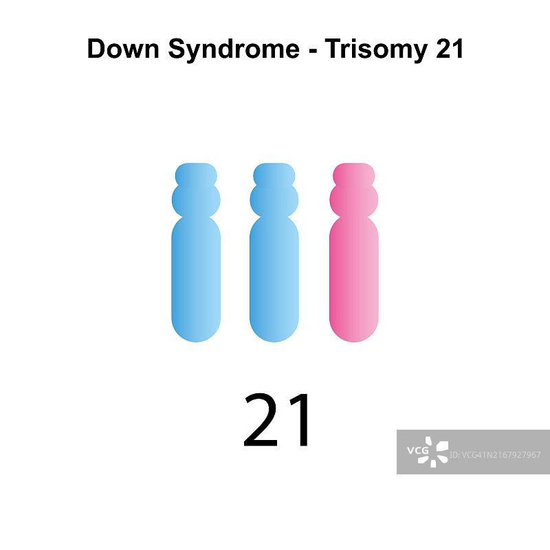 21三体综合征插图。图片素材