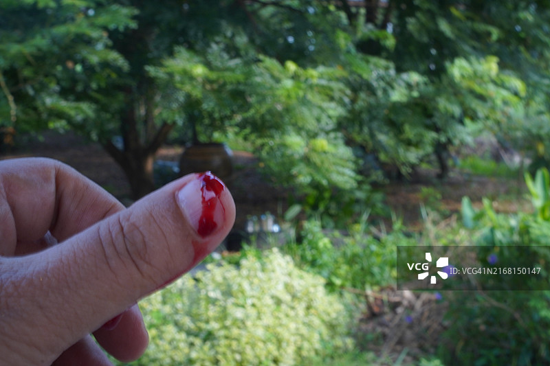 刀切到拇指图片素材