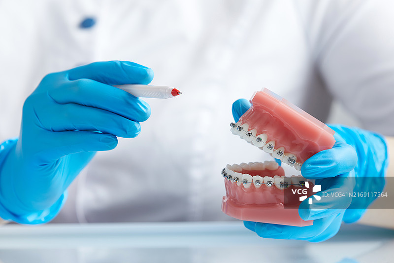 牙科医生展示带有金属牙套的人类下颌模型图片素材