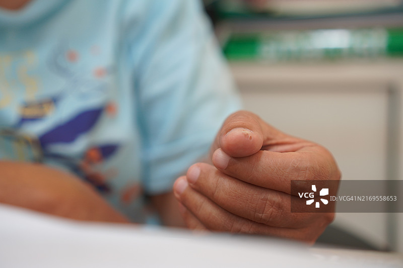 拇指上的刀伤图片素材