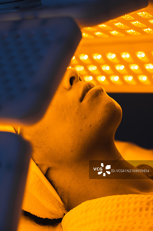 接受非侵入式光疗的女性痤疮面部图片素材