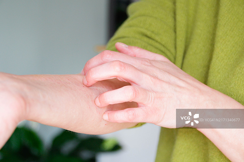 皮肤瘙痒图片素材