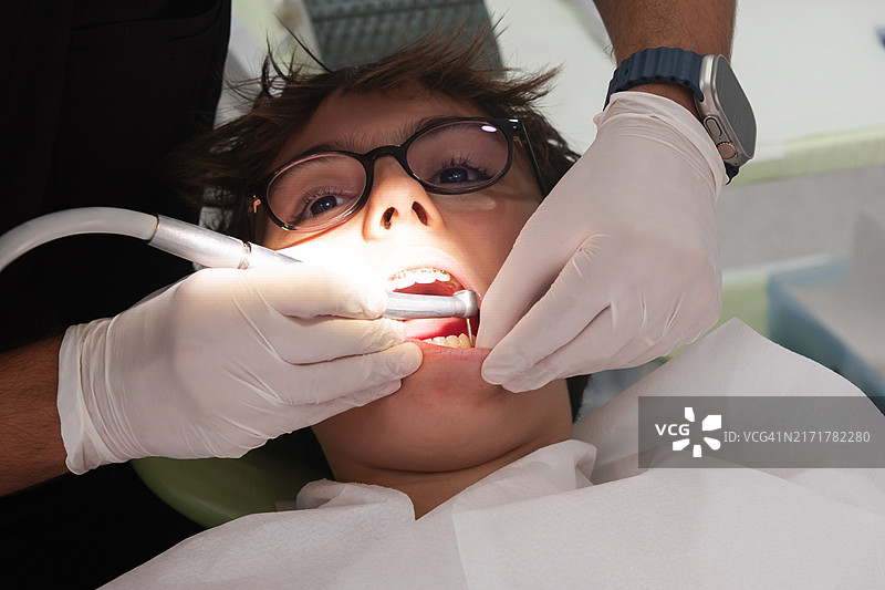 正畸之旅结束：儿童牙套已摘除，并已取模用于固定器图片素材