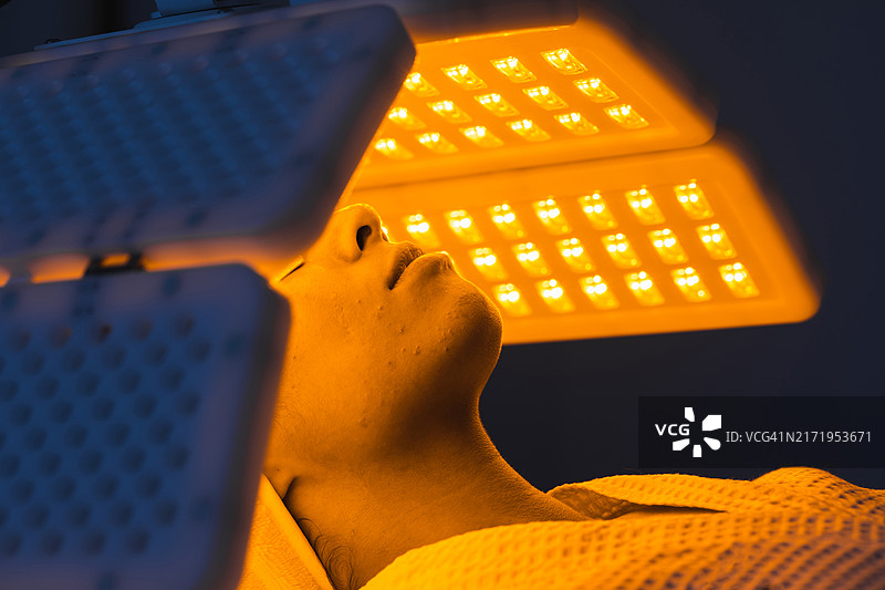 接受非侵入式光疗的女性痤疮面部图片素材