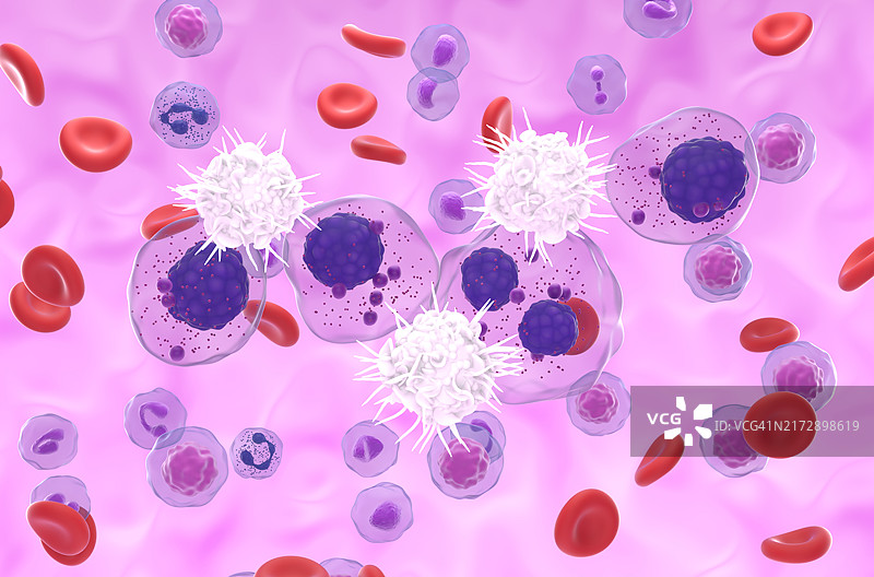 识别多发性骨髓瘤细胞的树突状细胞插图图片素材