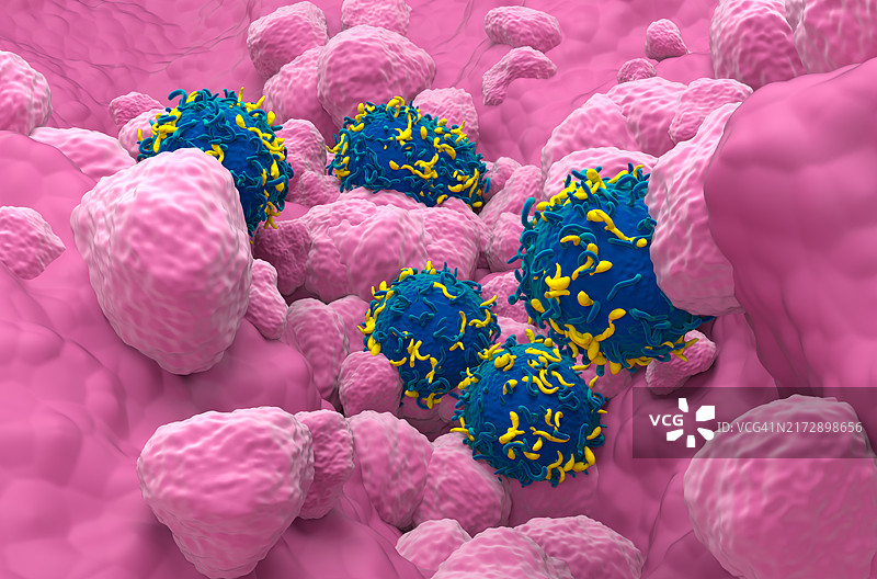 CAR-T细胞疗法治疗肺癌，图示图片素材