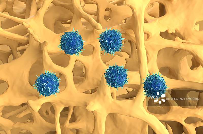 用于治疗骨质疏松症的CAR-T细胞疗法，图示图片素材