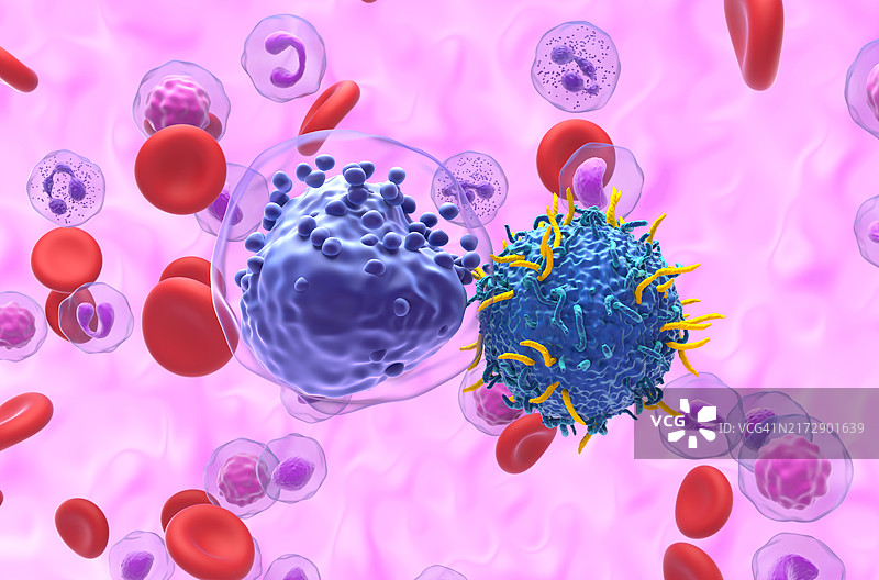 急性髓系白血病CAR T细胞疗法插画图片素材