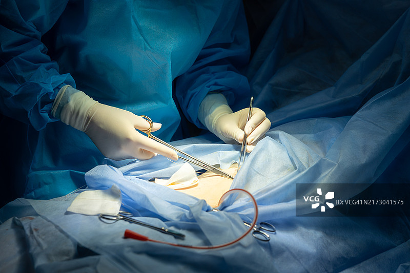 外科医生的手在缝合伤口。图片素材